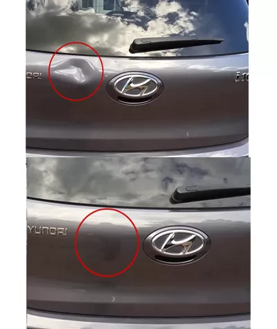 Boyasız Göçük Düzeltme Hyundai Bagaj Kapağı